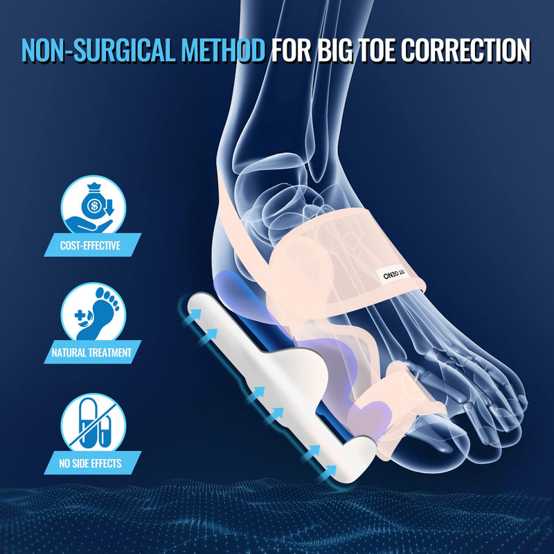 Bunion Corrector for Women Big Toe Upgraded Orthopedic Bunyon Splint w/Brace - Comfortable Foot Straightener 2PC