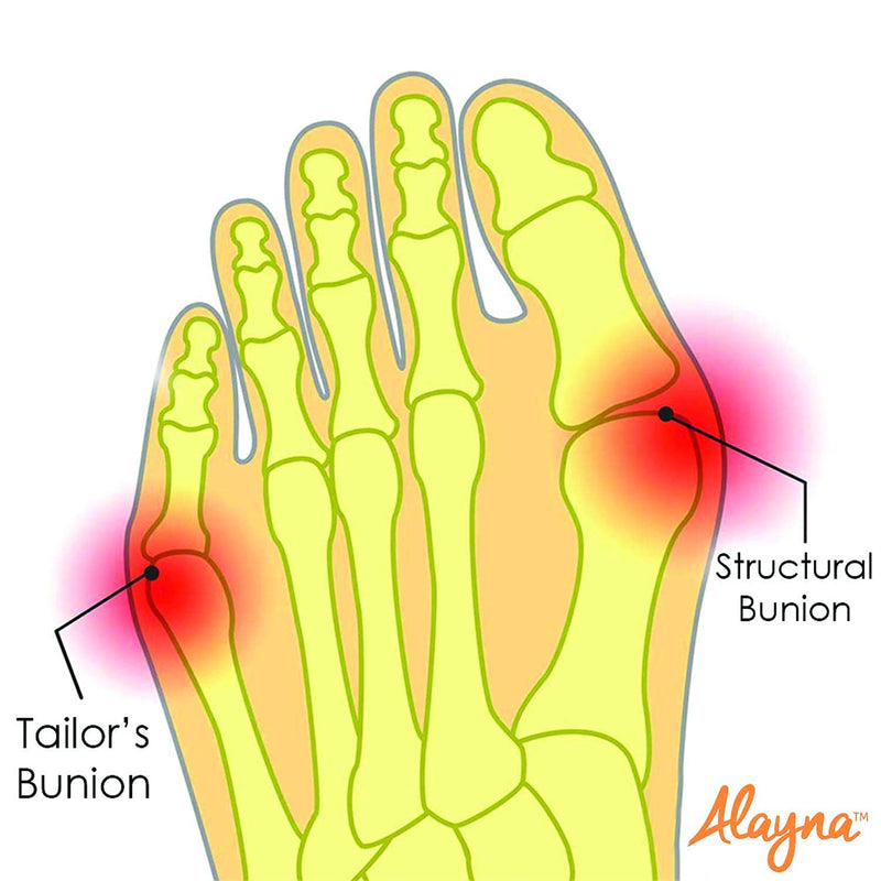 Bunion Corrector for Women and Men Big Toe Bunion Pain Relief Hallux Valgus Corrector Bunion Socks Splint Pads