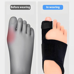 Bunion Corrector for Women and Men,Toe Separators to Correct Bunions for Pain Relief, Big Toe Separator, Toe Spacers and Straighteners