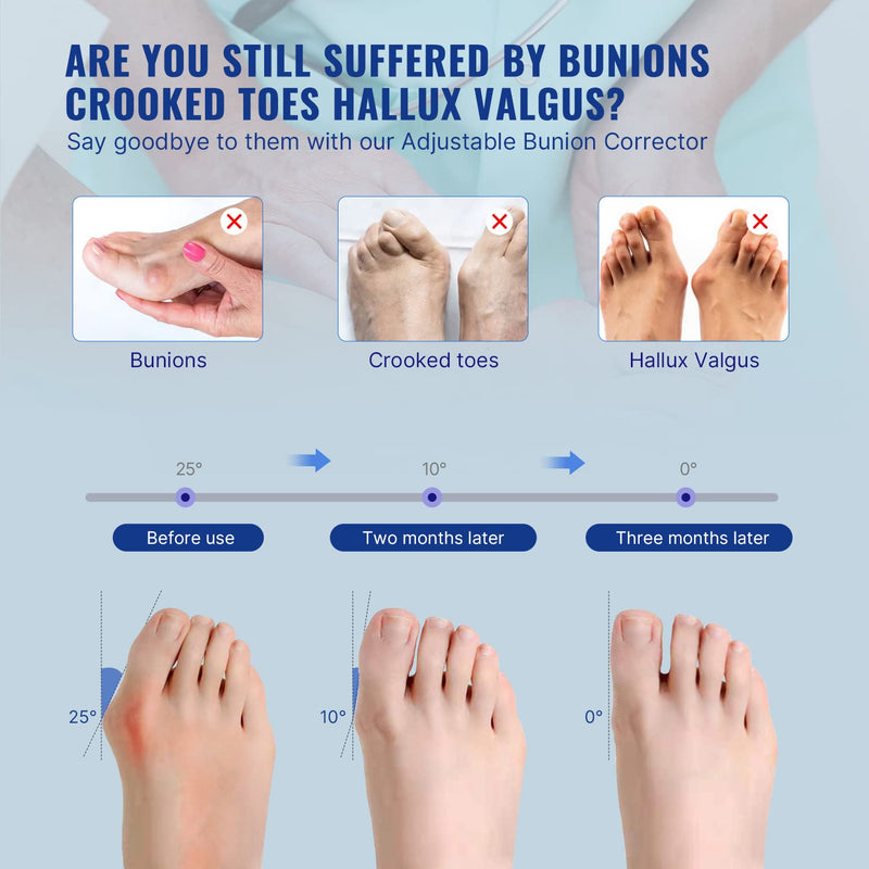 Bunion Corrector for Women Big Toe Adjustable for Men, Toe Straightener Bunion Relief Foot Brace Splint