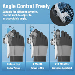 Bunion Corrector for Women and Men, Orthopedic Bunion Toe Straightener, Adjustable Bunion Splint Day Night Support