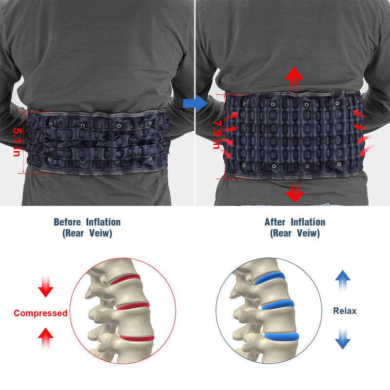 Decompression Back Belt for Lower Back Pain Relief- Spine Reset Device Lumbar Support for Lifting, One Size Fits 29-49 Waist Blue