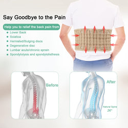 Decompression Back Belt for Lower Back Pain Relief- Spine Reset Device Lumbar Support for Lifting, One Size Fits 29-49 Waist Beige