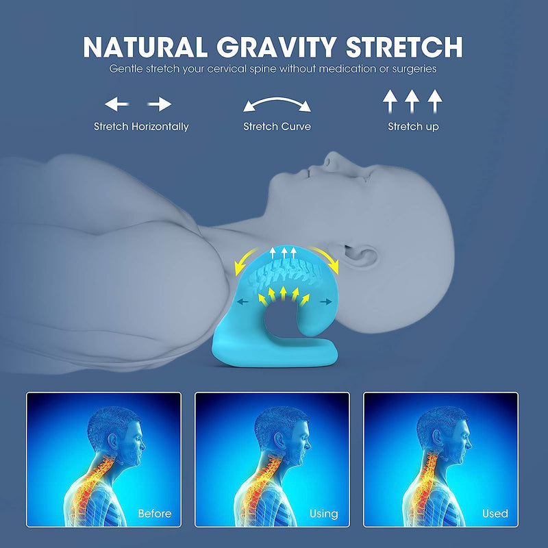 Neck and Shoulder Relaxer with Magnetic Therapy Pillowcase, Neck Stretcher Chiropractic Pillows for Pain Relief, Cervical Traction Device for Relieve TMJ Headache Muscle Tension Spine Alignment Black