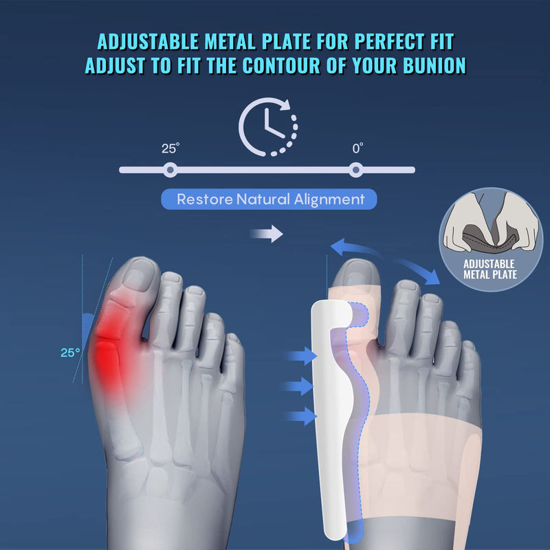 Bunion Corrector for Women Big Toe Upgraded Orthopedic Bunyon Splint w/Brace - Comfortable Foot Straightener 2PC